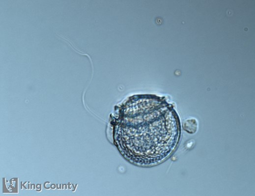 Photo of Dinophysis rotundata